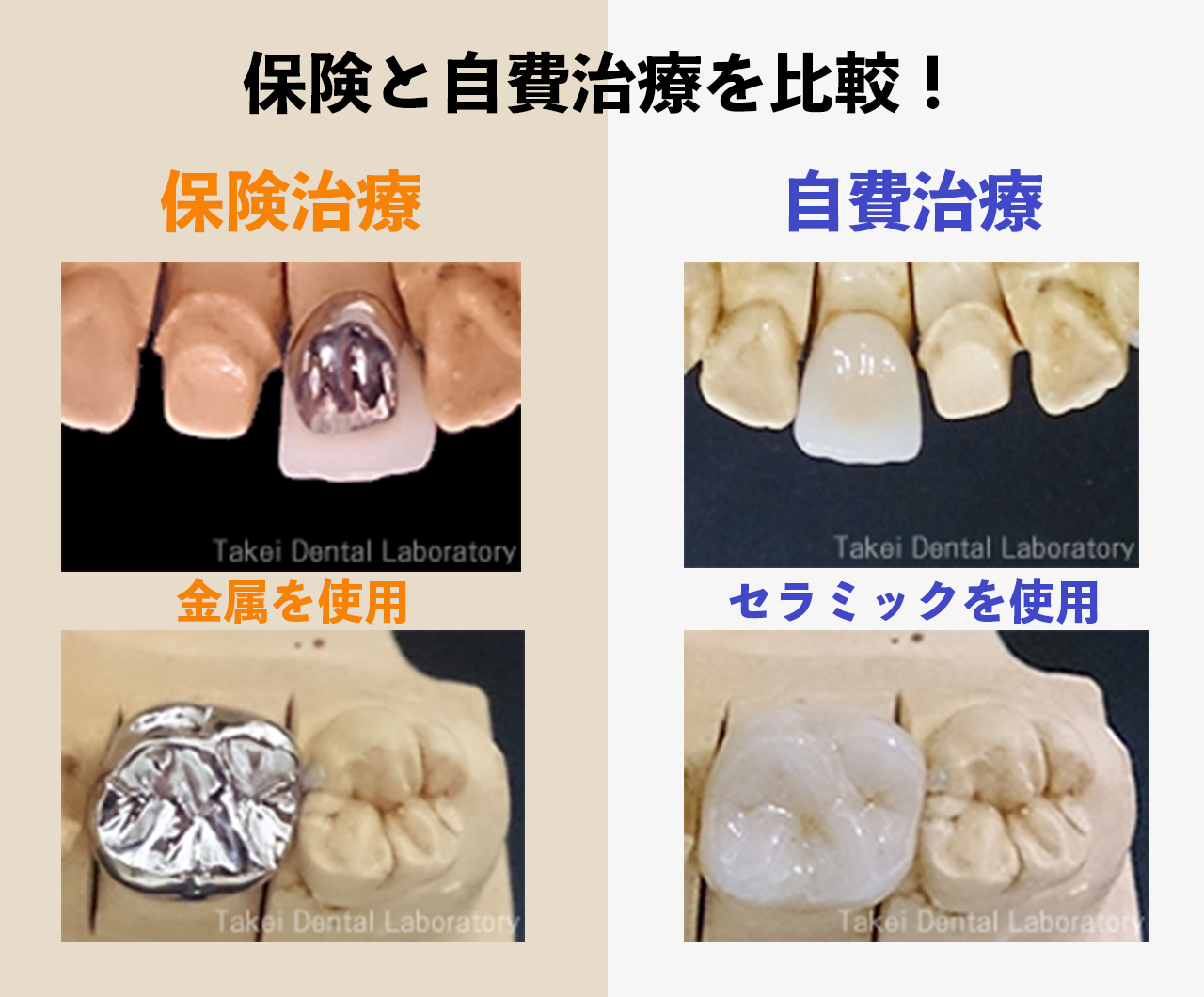 保険と自費治療の違い