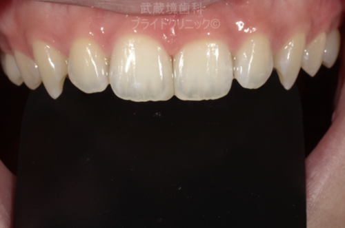 After