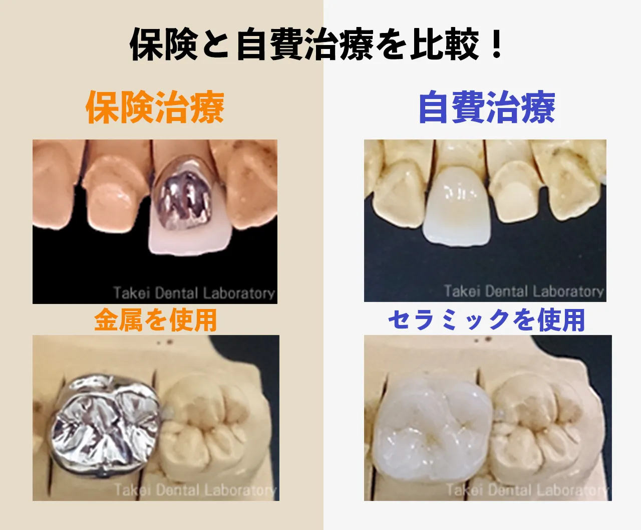 保険と自費治療の違い