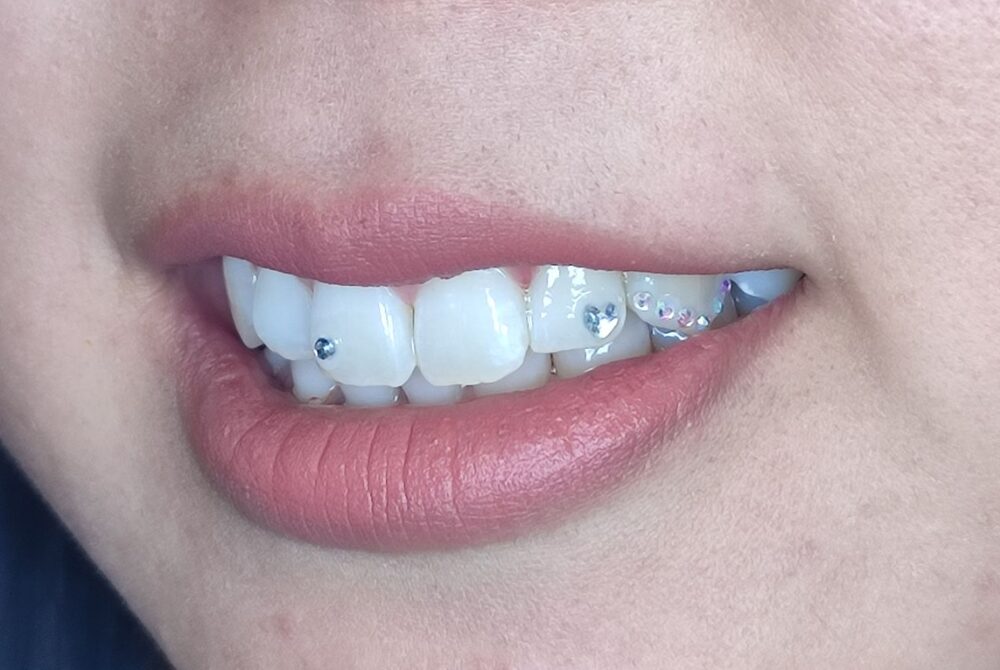After