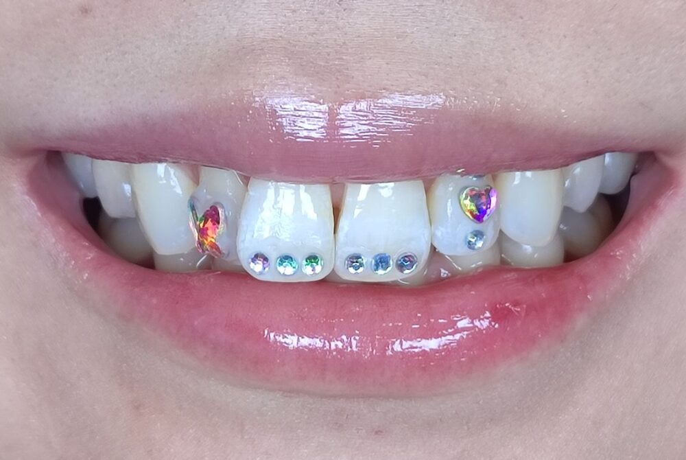 After